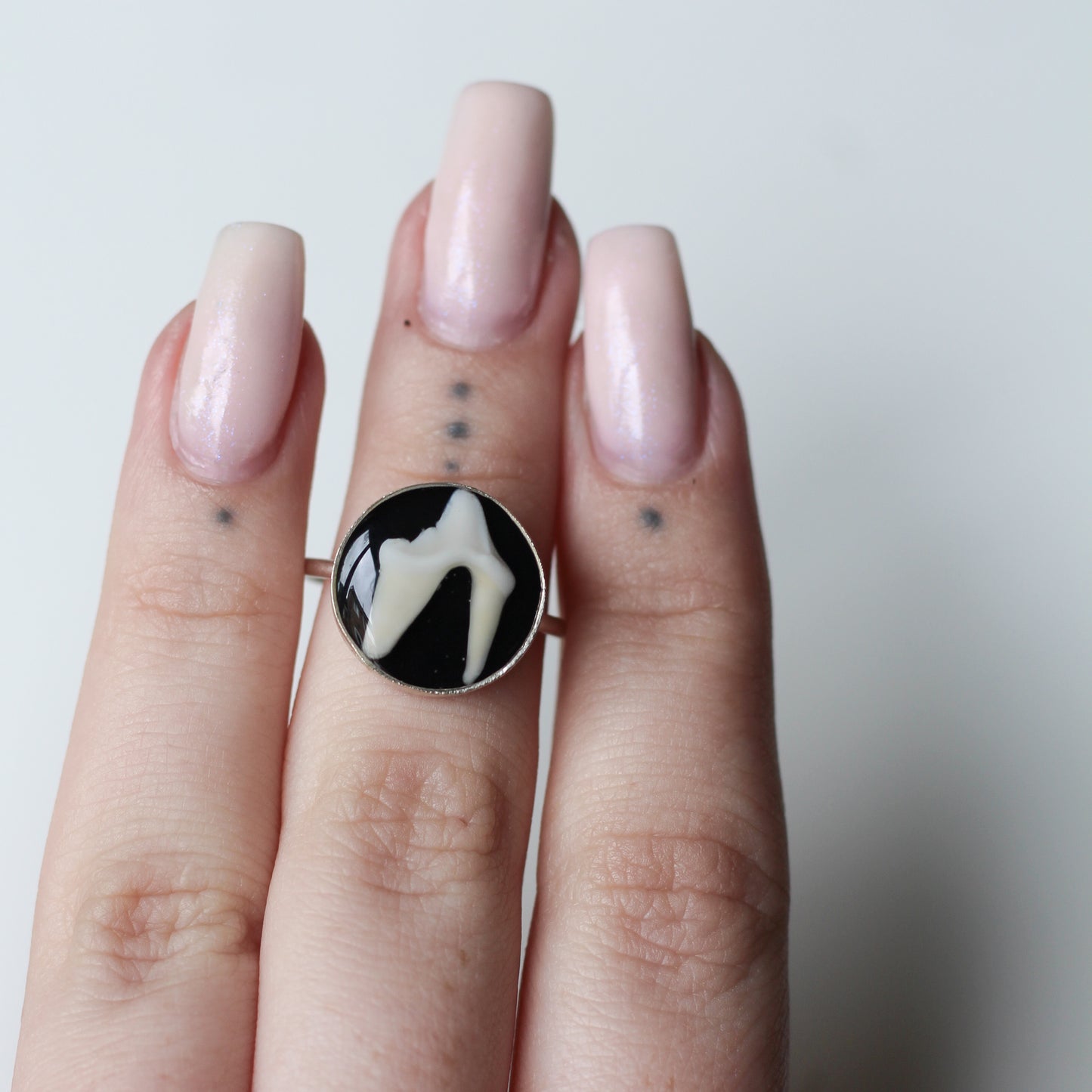 Adjustable Tooth Ring