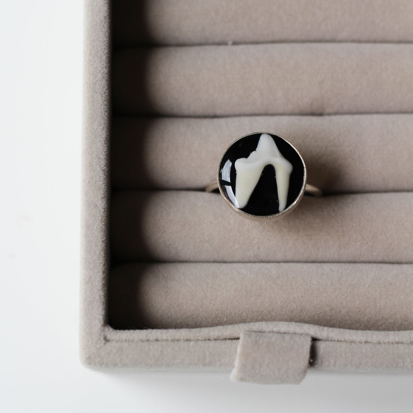 Adjustable Tooth Ring