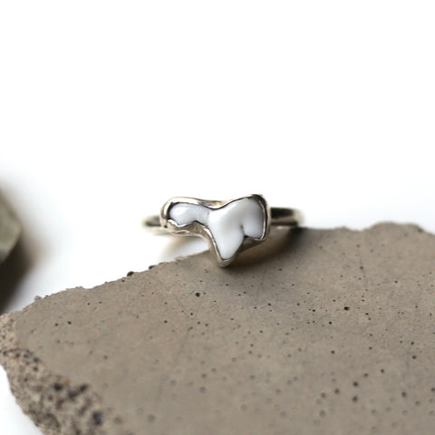 Custom Fitted Tooth Ring